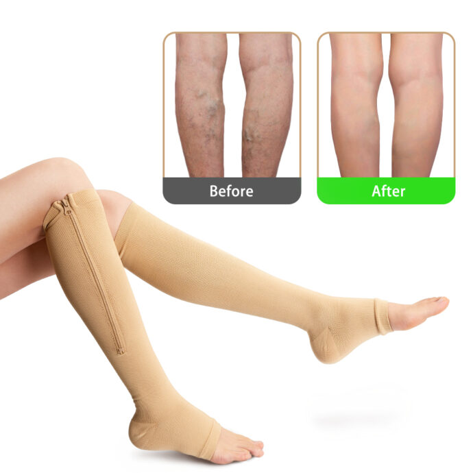 ⁦Bas de Compression Médical⁩ - الصورة ⁦2⁩