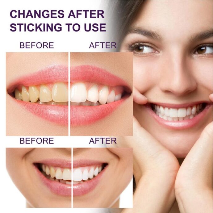 ⁦Dentifrice Blanchissant Correcteur de Couleur des dents EELHOE⁩ - الصورة ⁦3⁩
