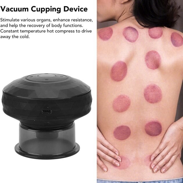 Ventouse Hijama Électrique - Soulagement de la Douleur