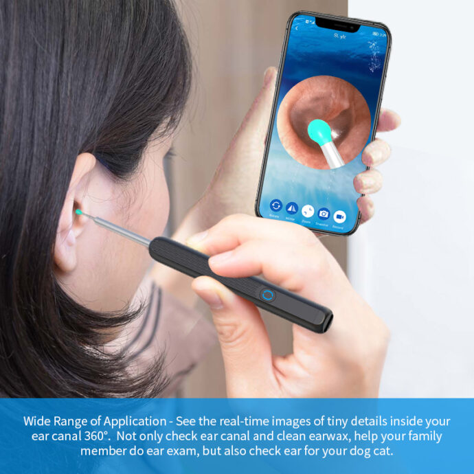⁦Otoscope Sans Fil NE3 Natfire – HD 1296p, Grand Angle 360°⁩ - الصورة ⁦2⁩