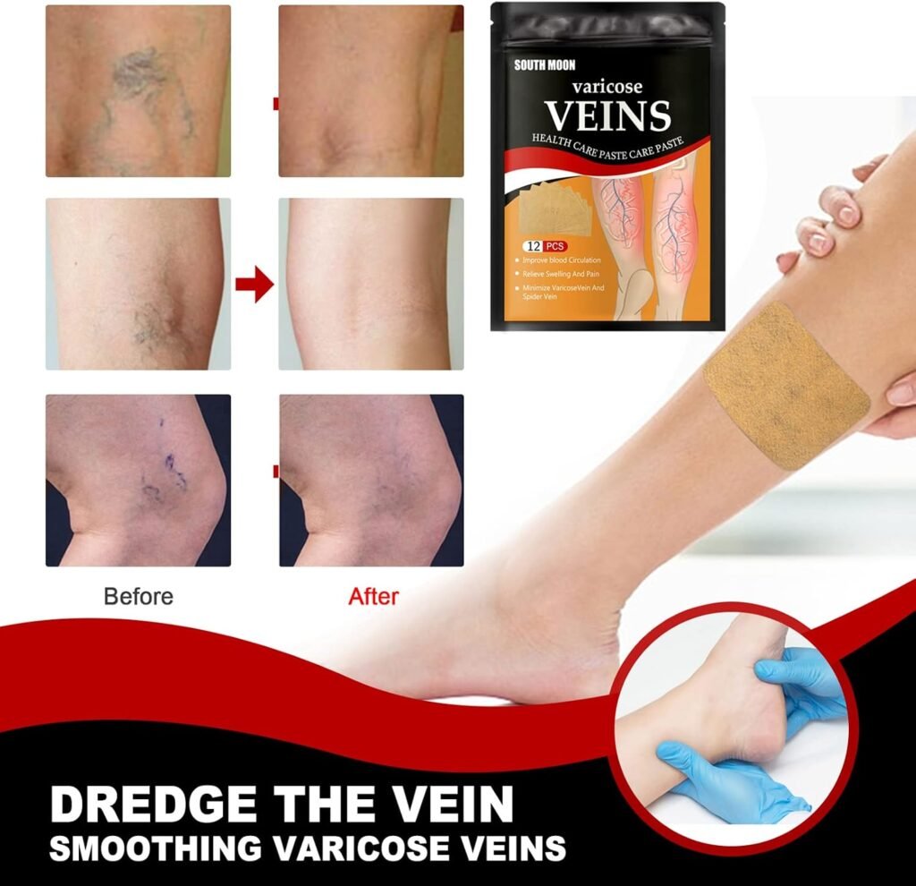 Patchs Anti-Varices Herbes Naturelles 12 Pièces — Soulagement Circulation