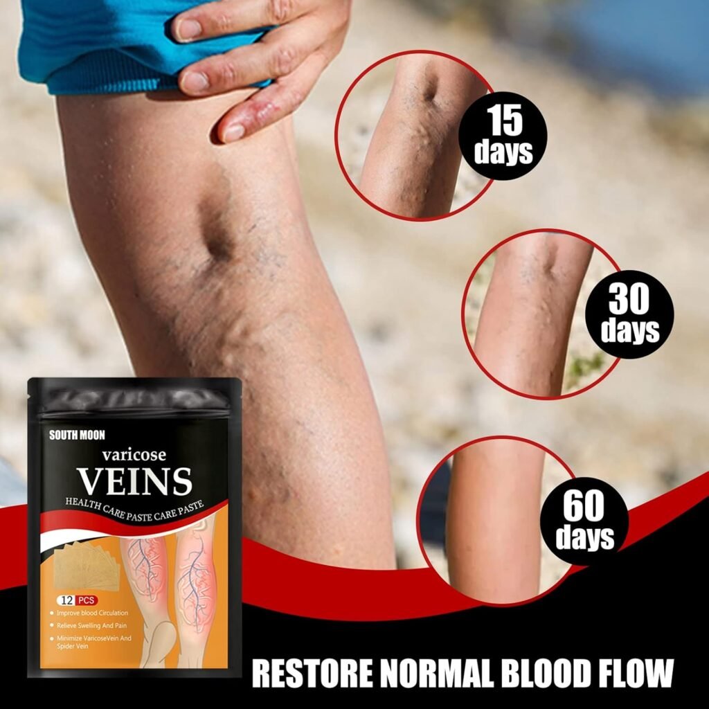 Patchs Anti-Varices Herbes Naturelles 12 Pièces — Soulagement Circulation