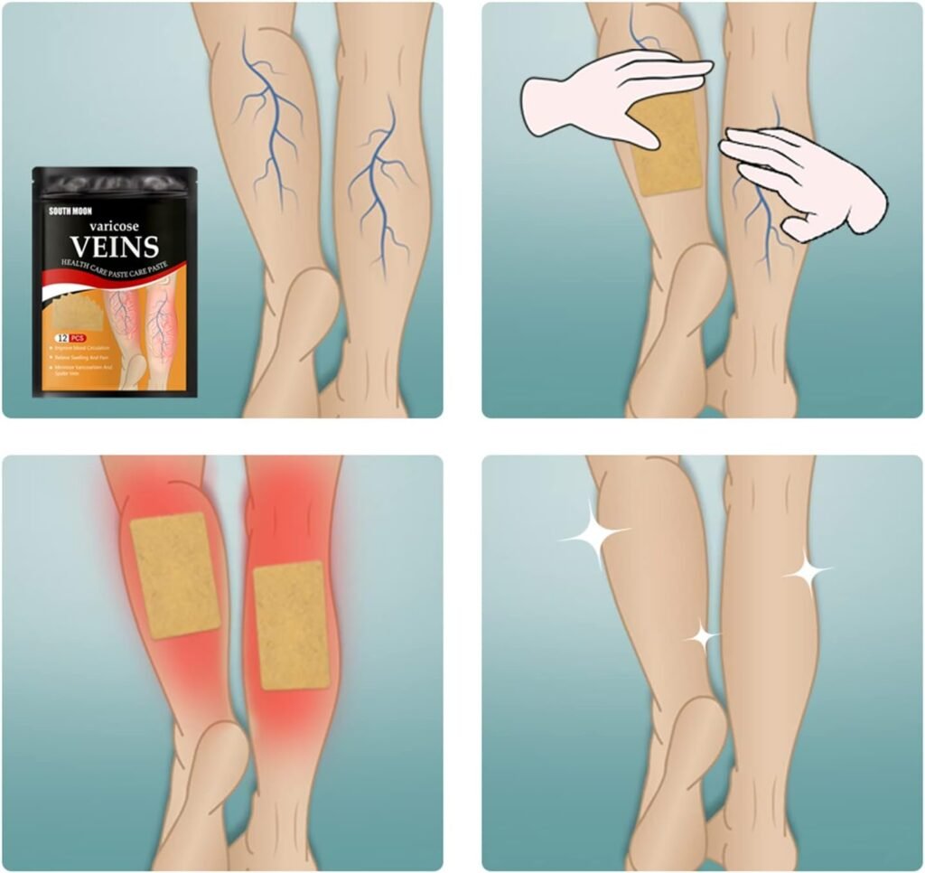 Patchs Anti-Varices Herbes Naturelles 12 Pièces — Soulagement Circulation