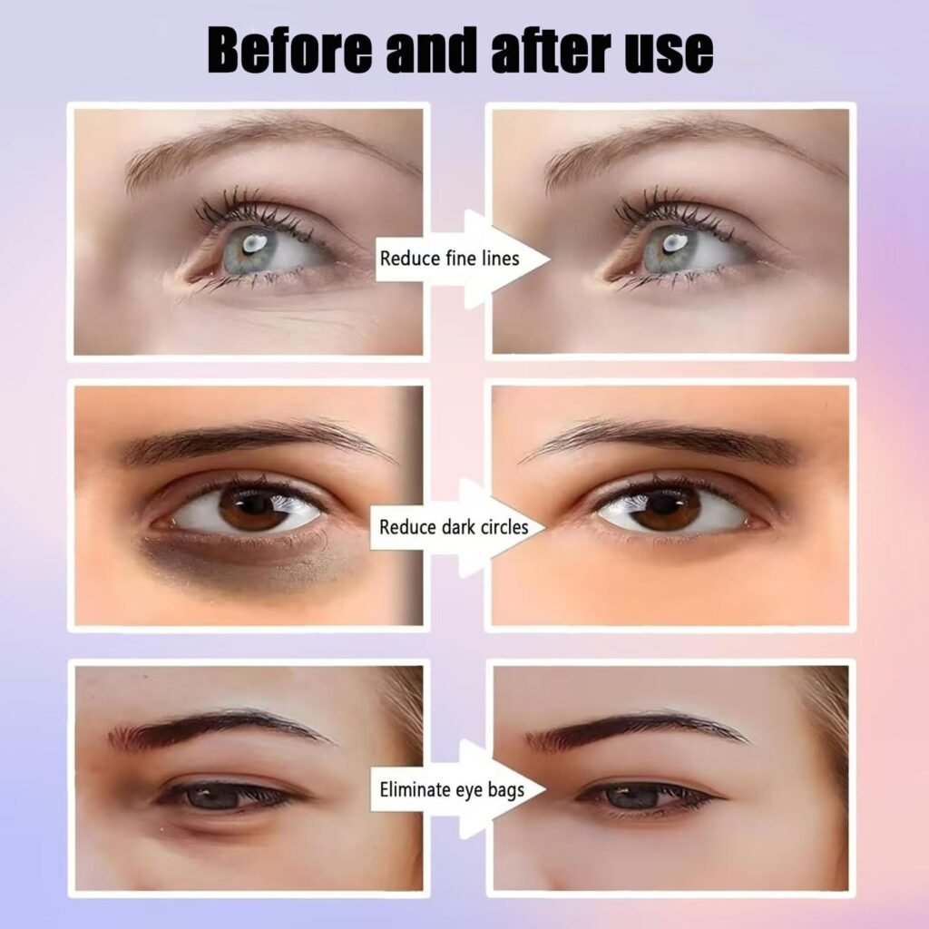 Masseur Yeux Lumière Rouge Anti-Poches & Rides