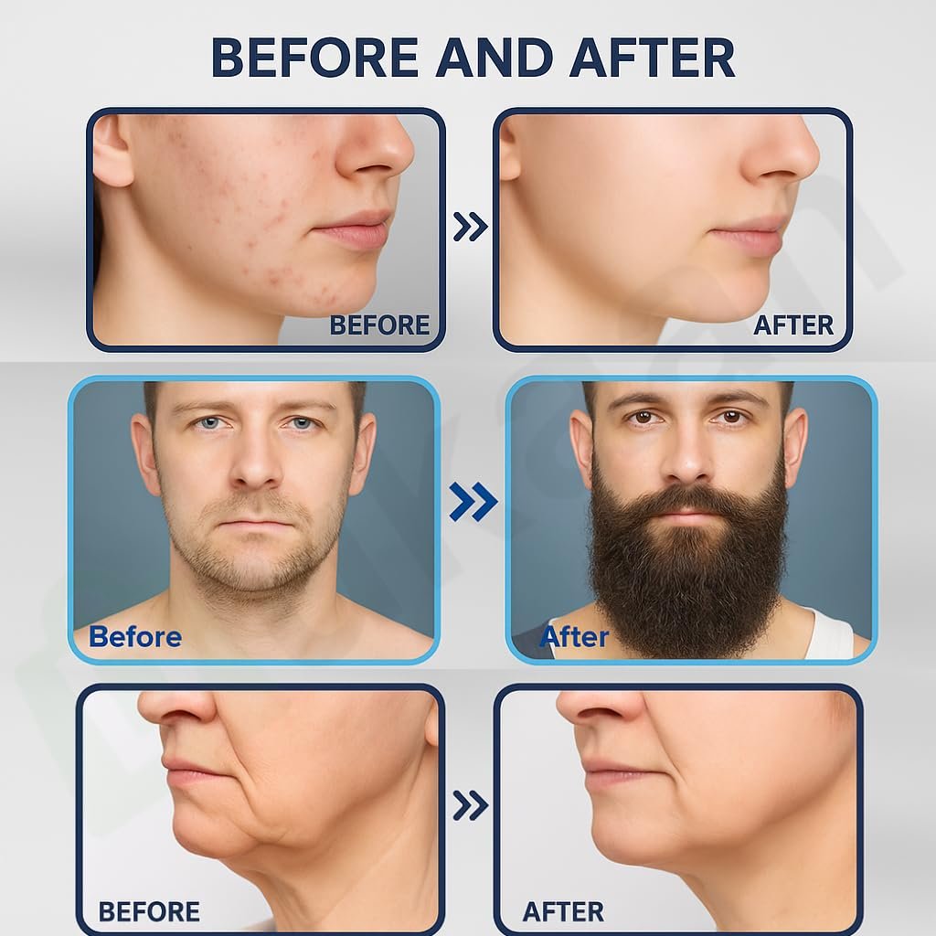 Derma Stamp à aiguilles réglables 0-3mm - Soin peau et barbe